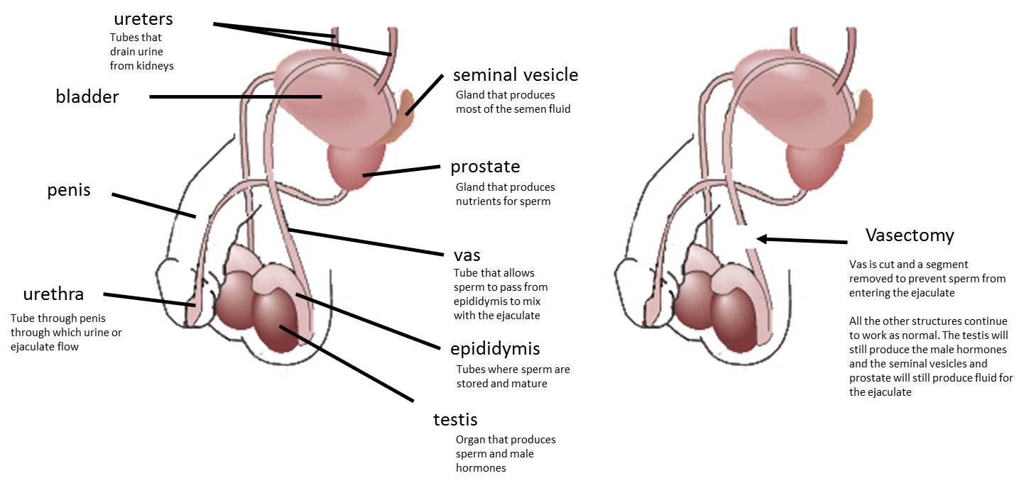 vasectomy diagram for website